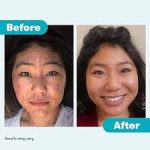 PanOxyl  Acne Foaming Wash Benzoyl Peroxide 10% Maximum Strength 156g