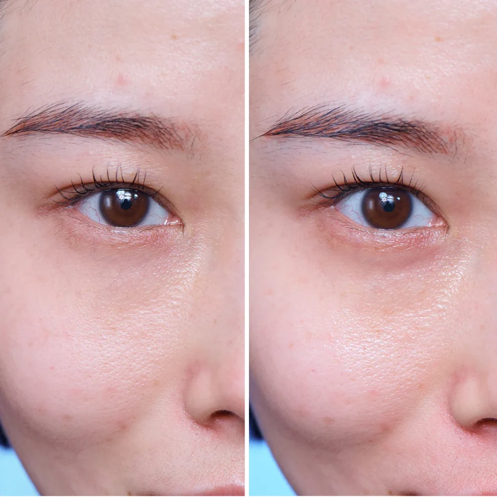 ADVANCED GÉNIFIQUE YEUX 15ml