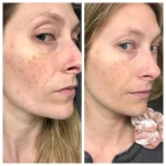 THE ORDINARY HYALURONIC ACID 2% + B5 30 ML