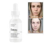 THE ORDINARY - NIACINAMIDE 10% + ZINC 1% - 30ml