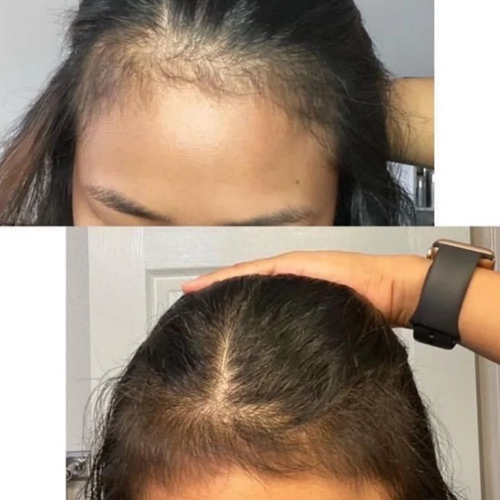 MIELLE - Rosemary Mint Scalp & Hair Strengthing Oil - 59ml MIELLE - Rosemary Mint Scalp & Hair Strengthing Oil - 59ml