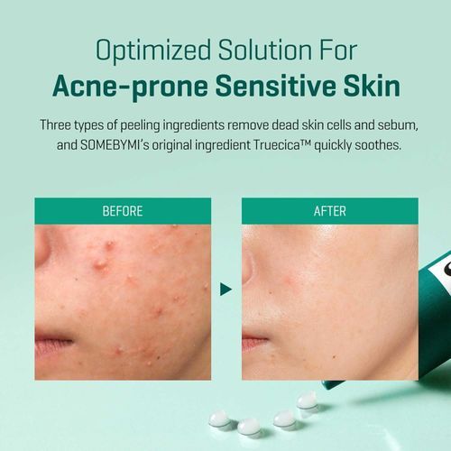 SOME BY MI AHA-BHA-PHA 14 Days Super Miracle Spot All Kill Cream 30ml