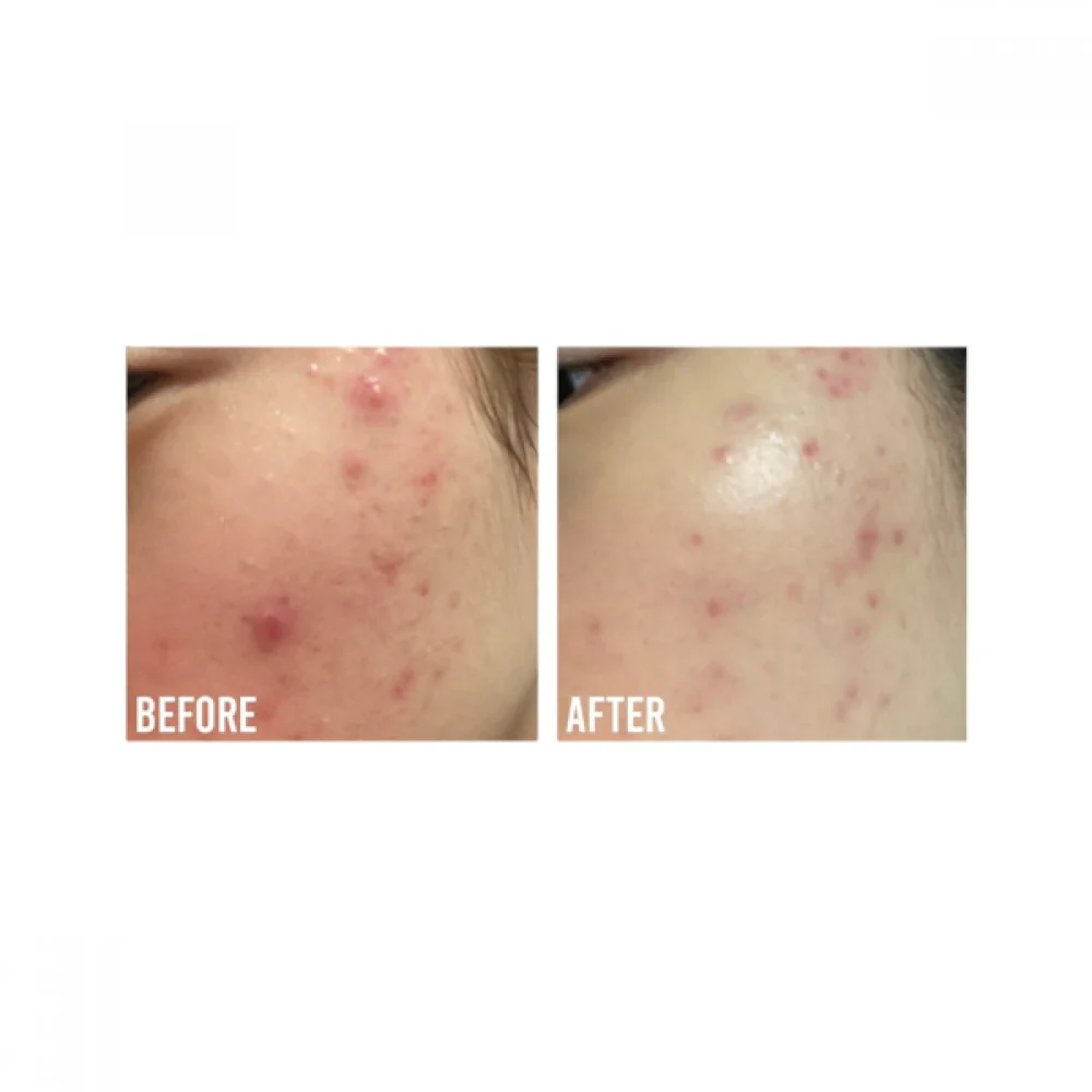 BEAUTY OF JOSEON CALMING SERUM GREEN TEA + PANTHENOL 30ML