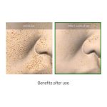 VT COSMETICS REEDLE SHOT 100 CICA REEDLE 50 ML