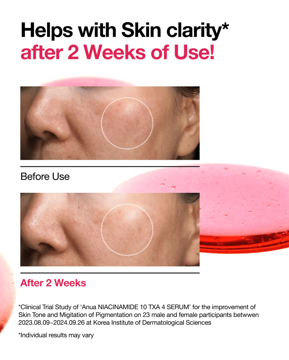 Anua Niacinamide 10% + TXA 4% Serum  Sérum à la Niacinamide 10% et à la TXA 4%