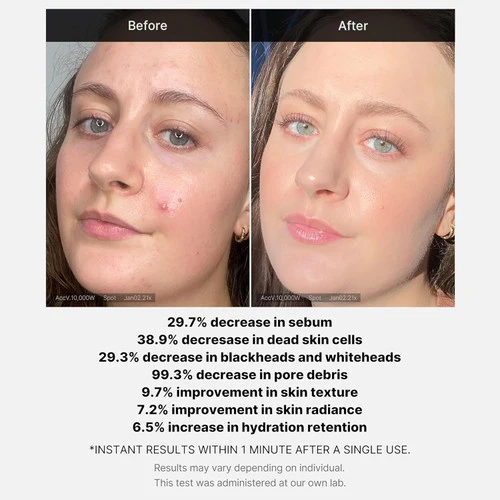 MEDICUBE 1 MIN RED ACNE SUCCINIC ACID PEEL 40 G MEDICUBE 1 MIN RED ACNE SUCCINIC ACID PEEL 40 G