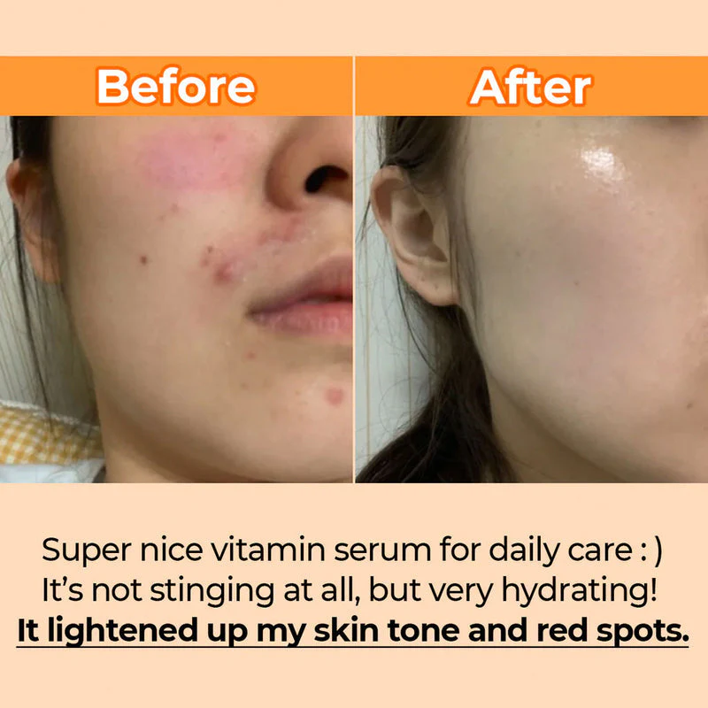 numbuzin Serum No 5 Goodbye Blemish 50 ml numbuzin Serum No 5 Goodbye Blemish 50 ml