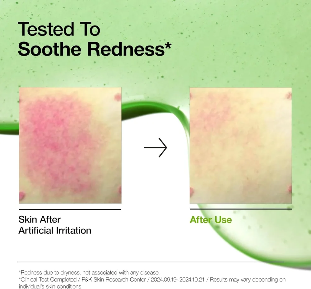 ANUA 10+AZELAIC ACID 10 HYALURON REDNESS SOOTHING SERUM 30 ML ANUA 10+AZELAIC ACID 10 HYALURON REDNESS SOOTHING SERUM 30 ML