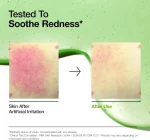 ANUA 10+AZELAIC ACID 10 HYALURON REDNESS SOOTHING SERUM 30 ML
