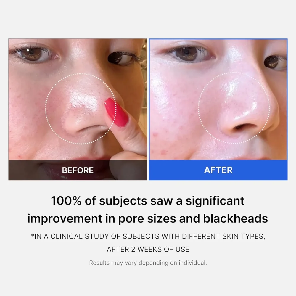 MEDICUBE - Zero Pore Pad 2.0 - 70 pads