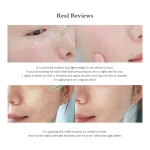 DR ALTHEA SKIN RELIEF ESSENCE 30 ML