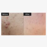 VT COSMETICS 300Reedle Shot 2ml x 10sachets