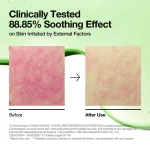 ANUA - Soothing Pad, Azelaic 10 + Hyaluron - 90 Pads