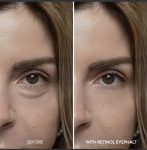 Dr Melaxin Retinol Eyebag Cream 10g