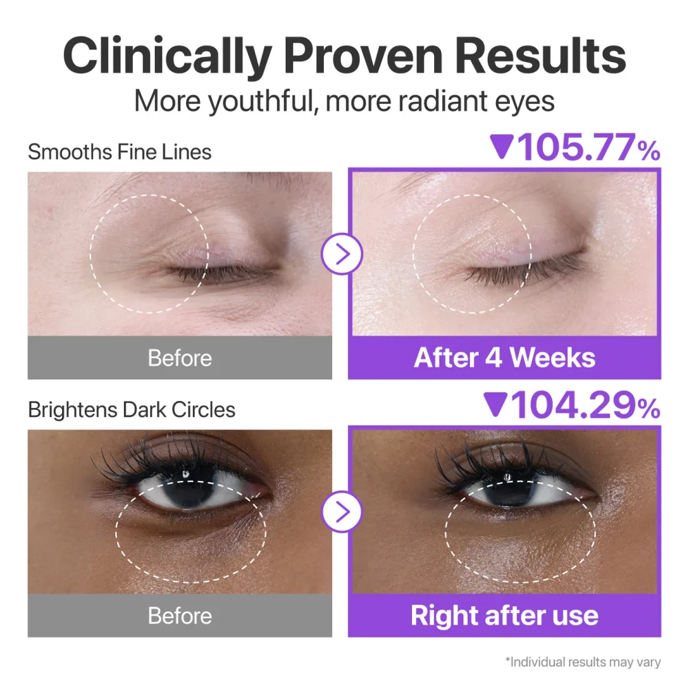 numbuzin Creme Yeux No  9 NAD+ Retinol Volumetox 10ml